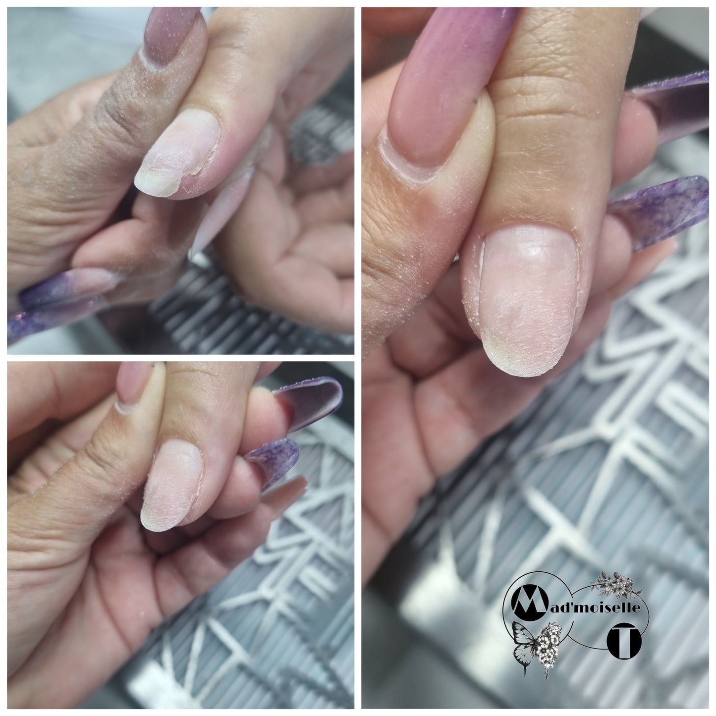 Acrygel online training